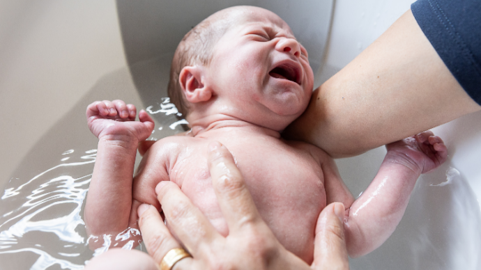 Une naissance sur cinq par césarienne